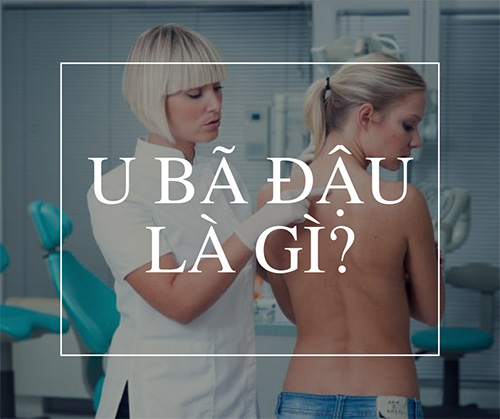 U bã đậu là gì?