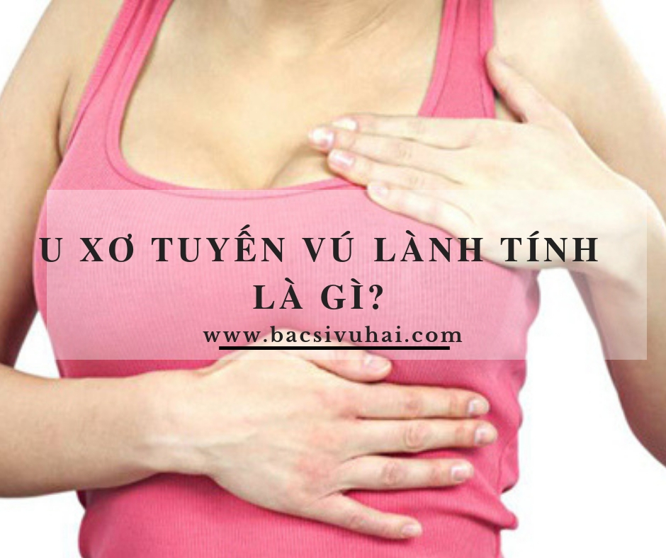 u xơ vú lành tính