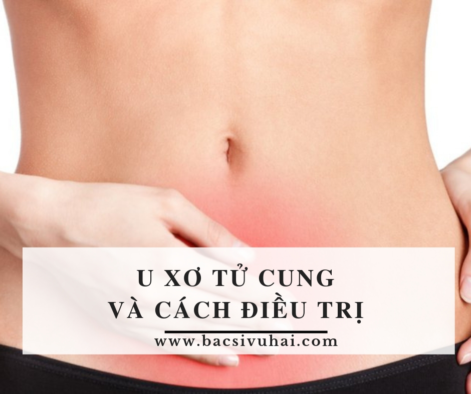 u xơ tử cung
